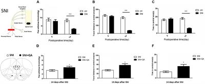 Network Analysis of miRNA and mRNA Changes in the Prelimbic Cortex of Rats With Chronic Neuropathic Pain: Pointing to Inflammation